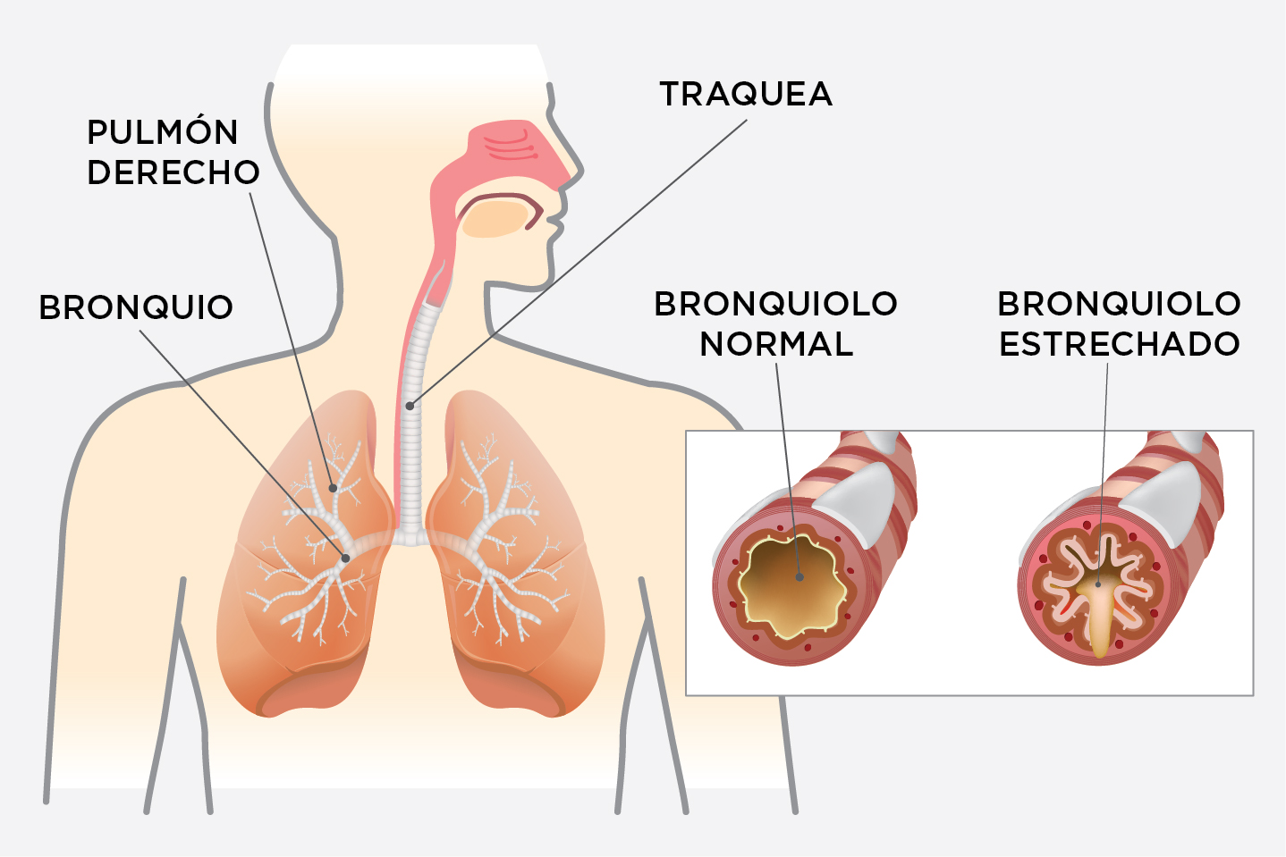 Sistema respiratorio - EPOC
