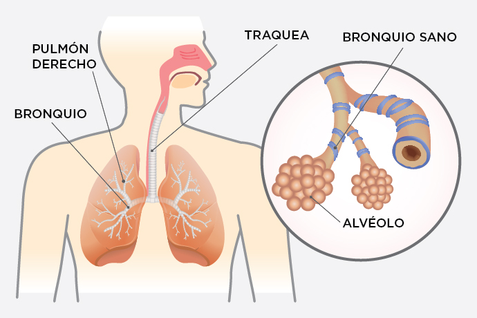 El error # 1 uso de esteroides en medicina, más 7 lecciones más