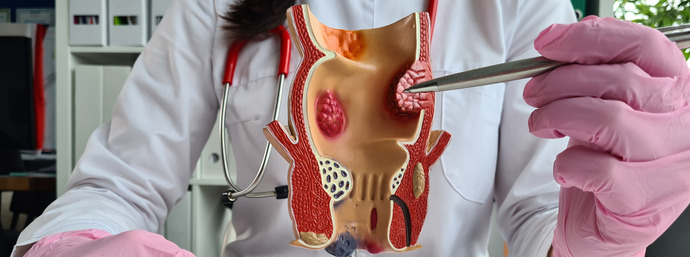 Médico mostrando un modelo del interstino