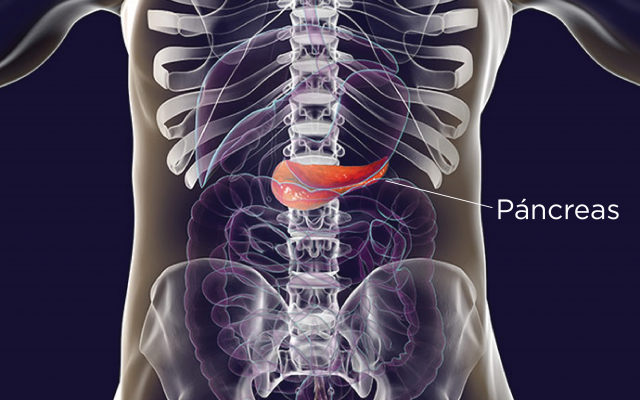 diabetes tipo 2 y páncreas