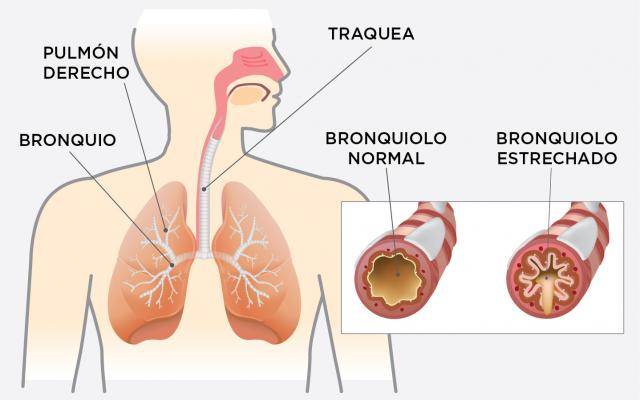 Sistema respiratorio - EPOC