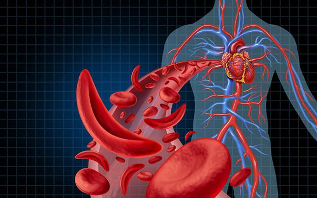 Todo lo que debes saber sobre la anemia