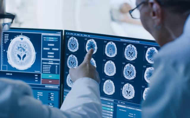 Médico examina cerebro sano