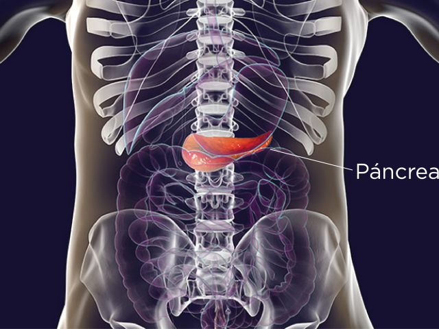 diabetes tipo 2 y páncreas