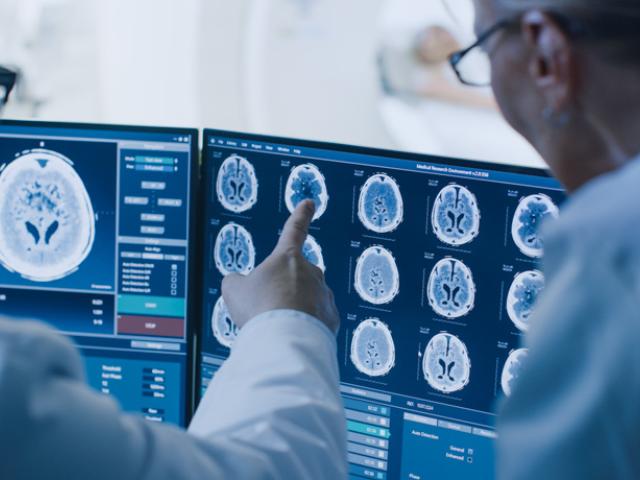 Médico examina cerebro sano