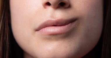Mujer con la boca torcida, un síntoma para prevenir el ictus.