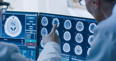 Médico examina cerebro sano