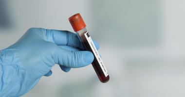 Análisis de RDW en sangre 